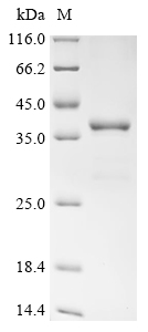 SDS-PAGE