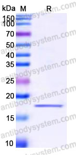 YHG70702, SDS-PAGE
