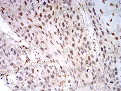 Валидация AntibodySystem RHC40105