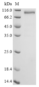 SDS-PAGE