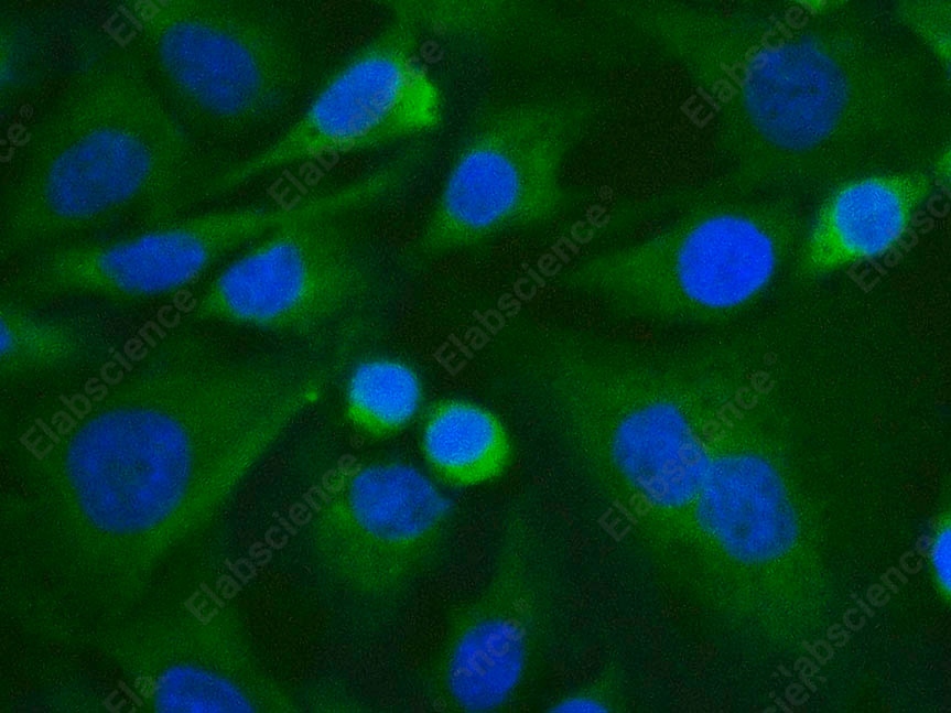Иммунофлуоресценция, Vinculin, клетки HeLa