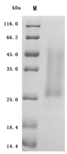 SDS-PAGE