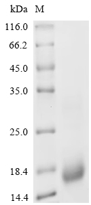 SDS-PAGE