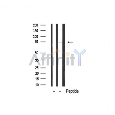 Валидация Affinity AF6418 - 3718