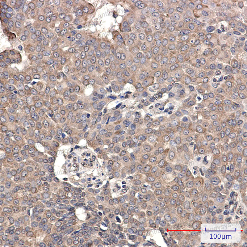 Валидация AntibodySystem RHC84901