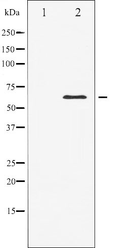 Валидация Affinity AF6213 - 3454