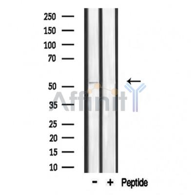 Валидация Affinity DF3506 - 14428