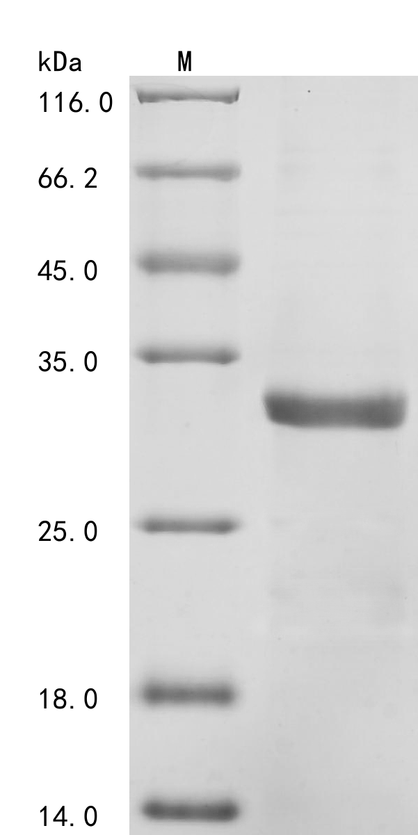 SDS-PAGE