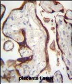 Валидация AssayVector ARM2062(3171)