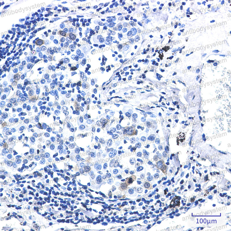 Валидация AntibodySystem RHC20202