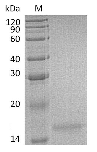 SDS-PAGE