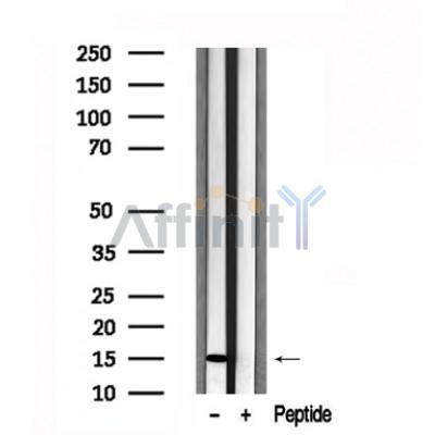 Валидация Affinity AF7614 - 4284