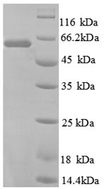 SDS-PAGE