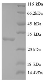SDS-PAGE