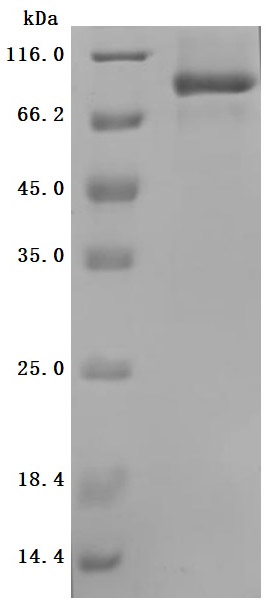SDS-PAGE