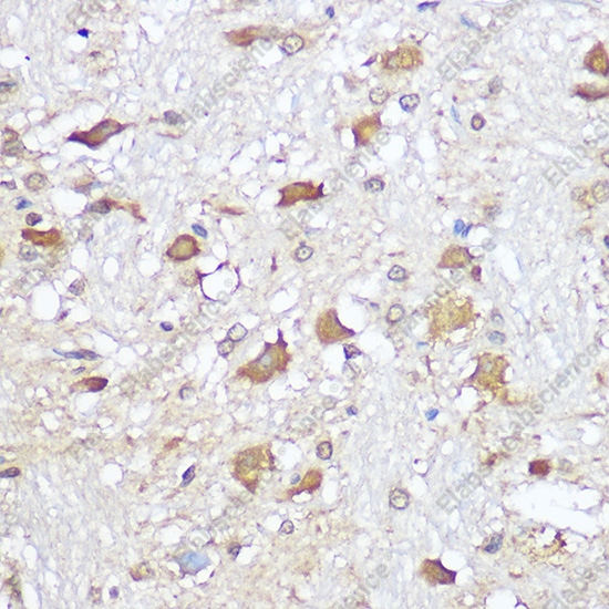 Иммуногистохимия, Mu Opioid Receptor, ткань мозга крысы