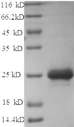 SDS-PAGE