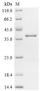 SDS-PAGE