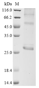 SDS-PAGE
