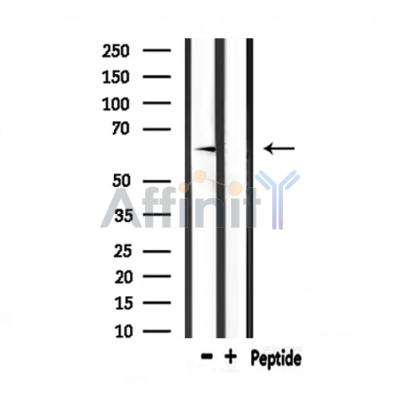 Валидация Affinity DF6914 - 18512