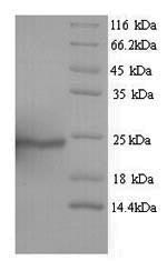 SDS-PAGE