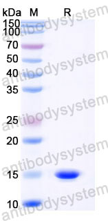 Валидация SDS-PAGE - AntibodySystem RZZ01809