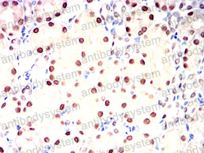 Валидация AntibodySystem RHE14902 (2000)