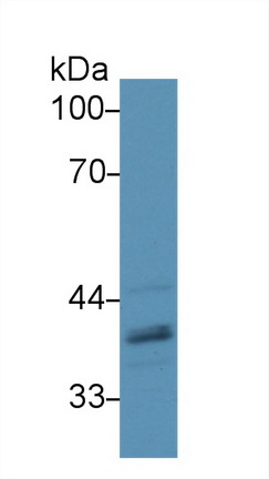 13895
