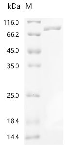 SDS-PAGE