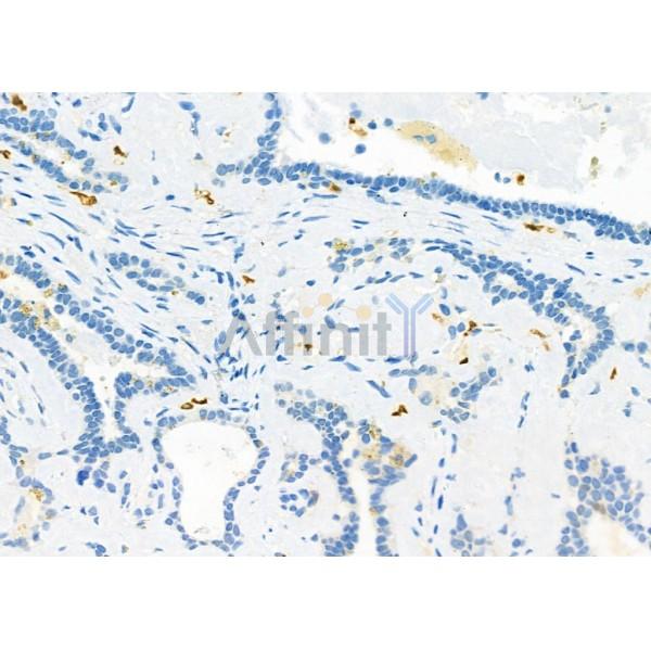 Валидация Affinity DF6536 - 17964