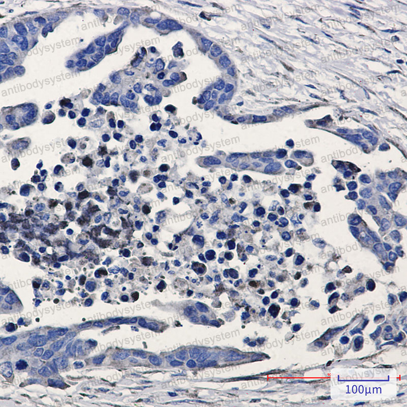Валидация AntibodySystem RHE72101