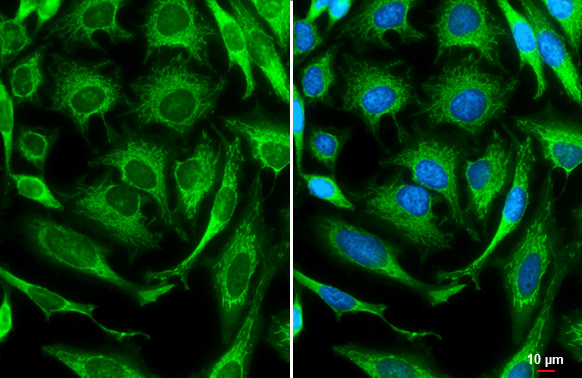 Валидация AssayVector ARM1284(744)
