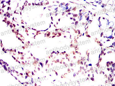 Валидация AntibodySystem RHE73902 (2295)