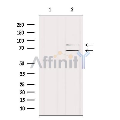 Валидация Affinity AF6056 - 3257