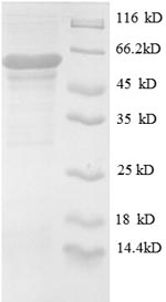 SDS-PAGE
