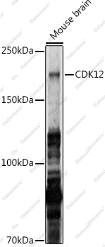 Вестерн-блоттинг, CDK12, мозг мыши