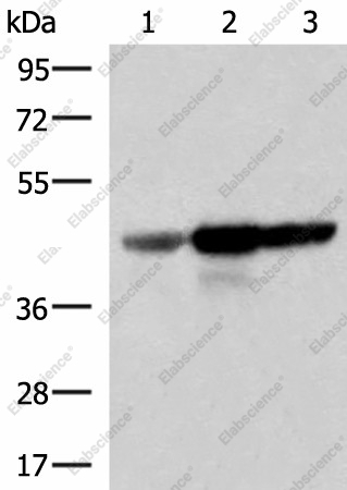 Вестерн-блоттинг, FDFT1, ткань мозга плода человека и клетки HepG2, HT29