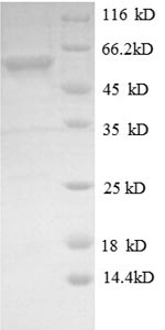 SDS-PAGE