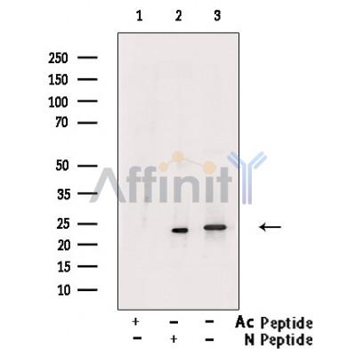 Валидация Affinity AF4360 - 2196