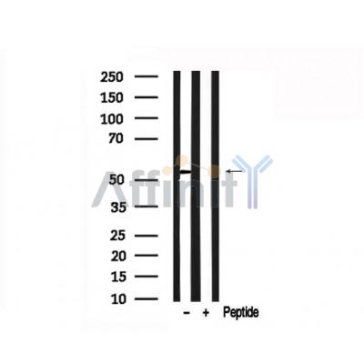 Валидация Affinity AF7535 - 4189