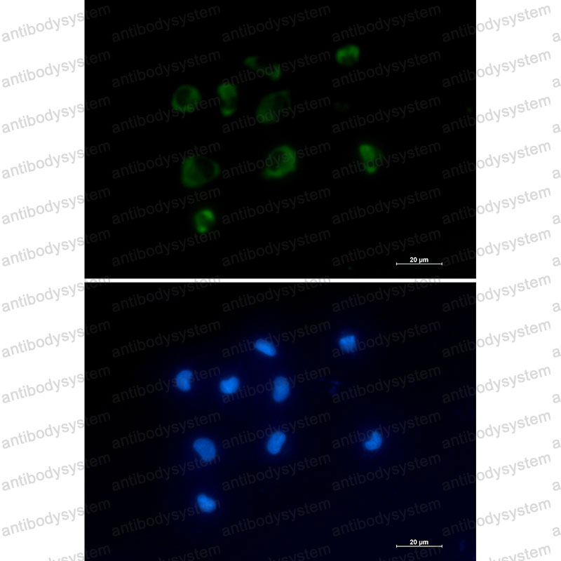 Валидация IF - AntibodySystem RHD29703