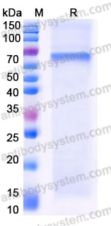 YHJ96802, SDS-PAGE