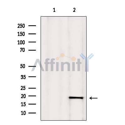 Валидация Affinity AF6431 - 3740