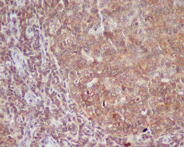 Валидация AntibodySystem RHE33802