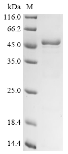 SDS-PAGE
