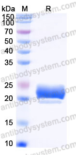 AHJ36104, SDS-PAGE