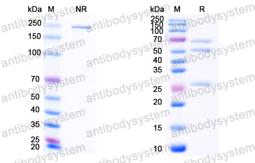 Валидация SDS-PAGE - AntibodySystem DHJ59501