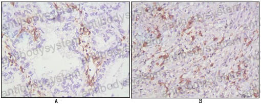 Валидация AntibodySystem RHD80807