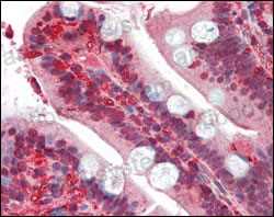 Валидация AntibodySystem RHH09504