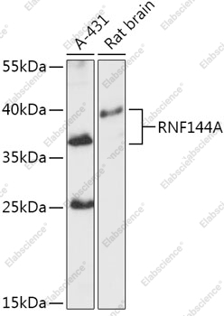 Вестерн-блоттинг, RNF144A, различные клеточные линии